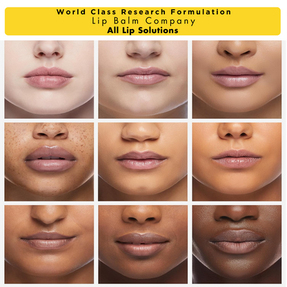 بسته های خانوادگی شخصی سازی شده بالم لب