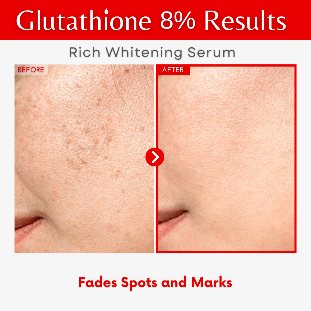 glutathione serum before and after HA Rejuve: Micro-Injected & HA Can Remove Years of Sun Damage & Photos New Jersey Ovay Natural Glutathione 8% Serum