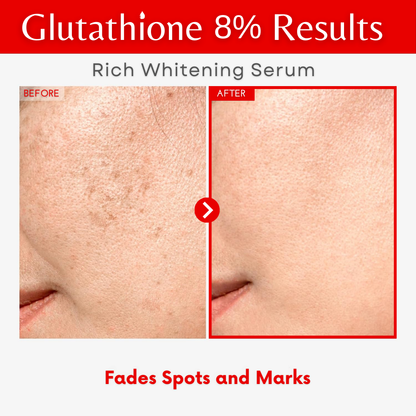 Ovay Natural Glutathione 8% Serum – Advanced Brightening & Antioxidant Care 30ML