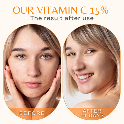 Ovay Natural Vitamin C 15% Serum – Brighten, Firm & Protect Your Skin 30ML