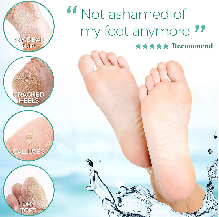 For Dry/Dead Skin, Cracked Heels, Calluses, Dry Toes