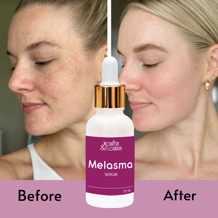 Nourish & Flourish Melasma Serum